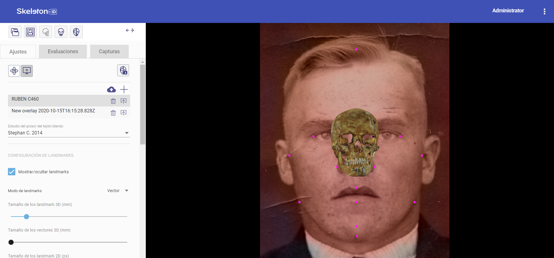 Escena de solapamiento cráneo-cara de Skeleton-ID