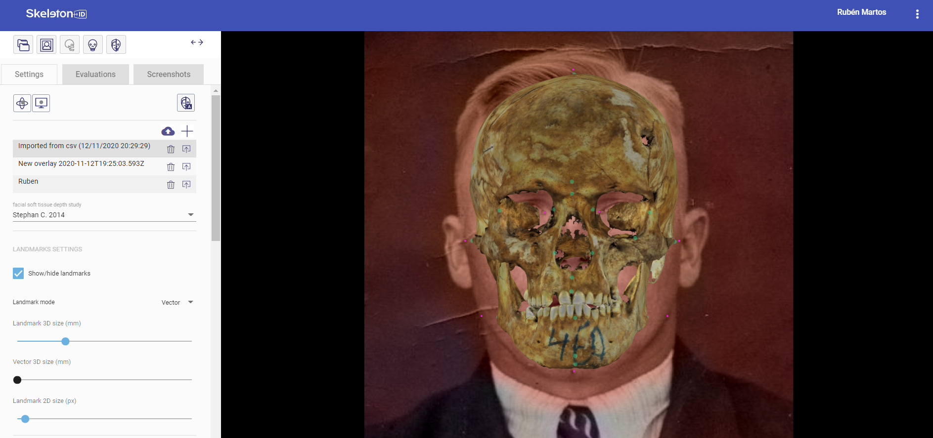 Skull-face overlap obtained using the POSEST-SFO algorithm