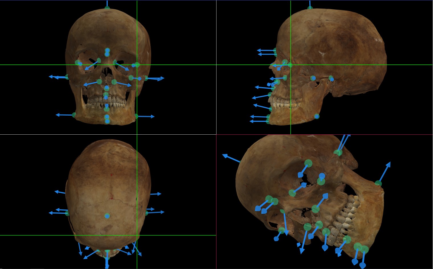 A screenshot of Skeleton·ID showing a 3D skull with craniometric landmarks (green points) and soft-tissue vectors (blue arrows) pointing towards the corresponding facial landmarks